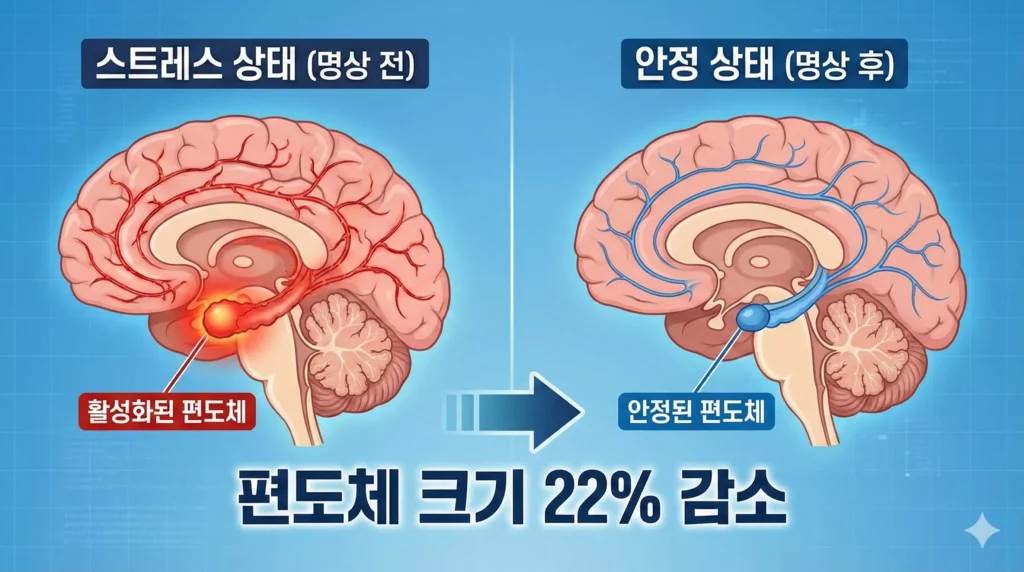 마음챙김 명상과 스트레스 관리 - 뇌 활동 변화 인포그래픽