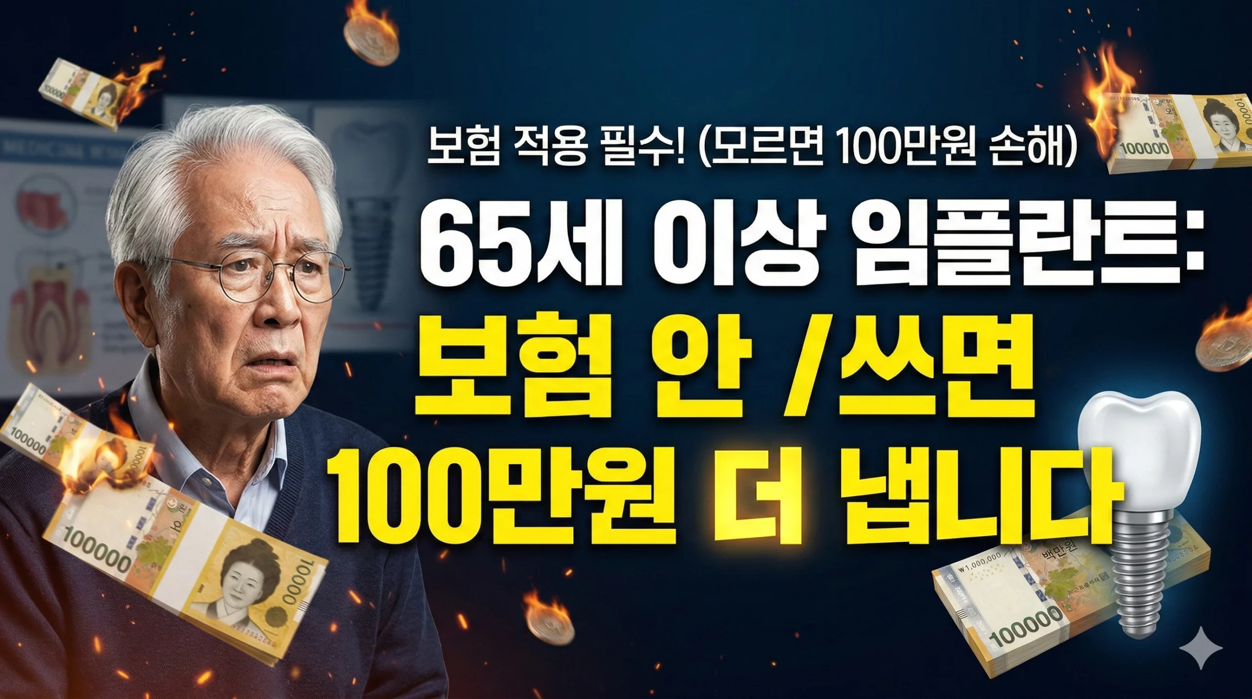 65세 이상 임플란트 알아보기 대표 이미지